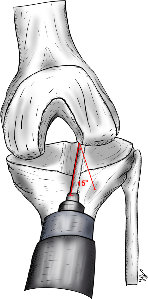 Fig. 2