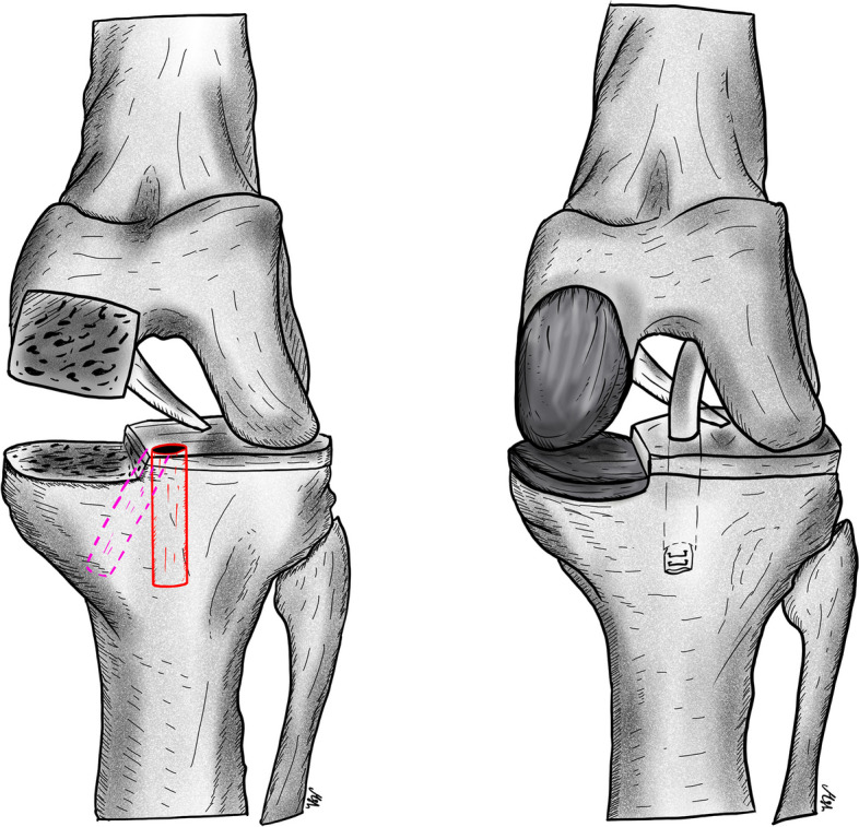 Fig. 1