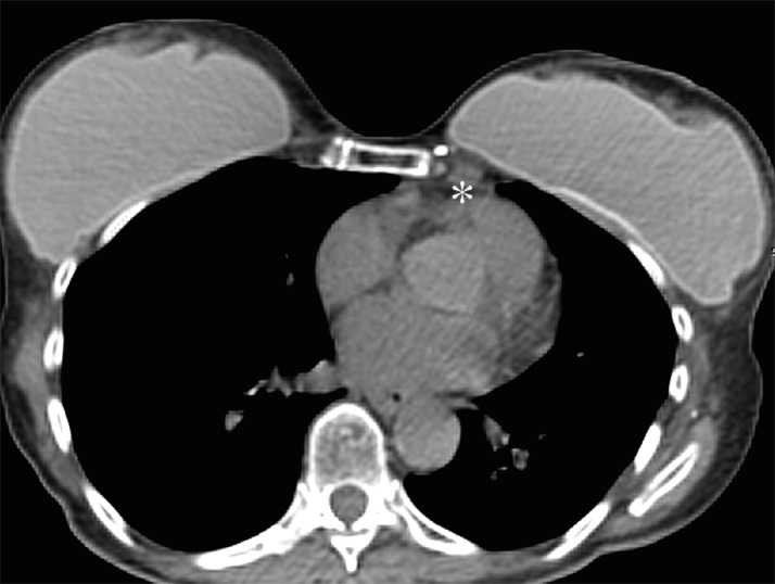 Figure 1c: