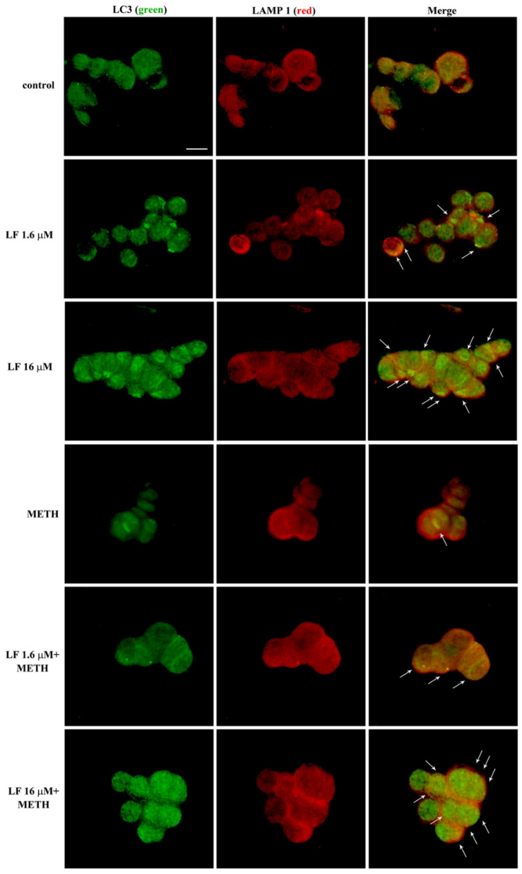 Figure 14