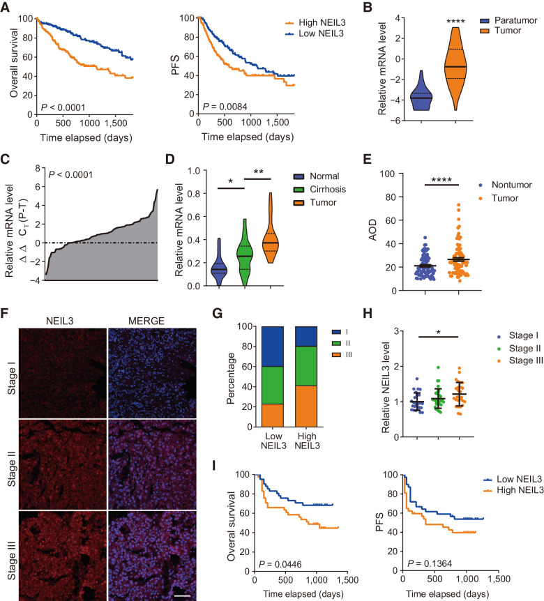 Figure 1. NEIL3 overexpression correlates with unfavorable outcome in HCC. A, NEIL3 mRNA overexpression correlates with reduced overall survival and progression-free survival (PFS). TCGA LIHC cohort, Cox regression from 370 patients. B, NEIL3 mRNA is overexpressed in HCC compared with nontumor tissue. TCGA LIHC cohort, medians, and quartiles from 50 patients each. C, NEIL3 mRNA is overexpressed in HCC compared with nontumor tissue in Renji HCC cohort. Results from 102 patients; Student t test. D, NEIL3 mRNA level increases from normal tissue, cirrhotic liver tissue to HCC tissue. Medians and quartiles from 20 patients each. E, IHC staining quantification (average optical density, AOD) showed that NEIL3 increases in HCC compared with paired nontumor tissue. Means ± SEM from Renji #1 Cohort, 80 patients. F, Images of NEIL3 staining in different TNM stages. Scale bar, 200 μm. G, Percentage of patients in different TNM stages with high or low NEIL3 level. (n = 82). H, NEIL3 level in different TNM stages. Medians and SD from 84 patients. I, NEIL3 overexpression correlates with reduced overall survival and PFS in Renji #2 Cohort. Cox regression analysis from 82 patients. *, P < 0.05; **, P < 0.01; ****, P < 0.0001; Student t test.