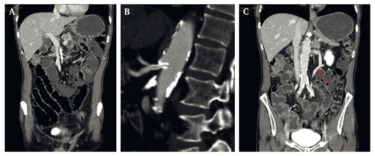 Figure 2