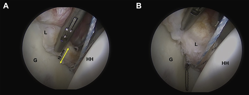 Fig 6