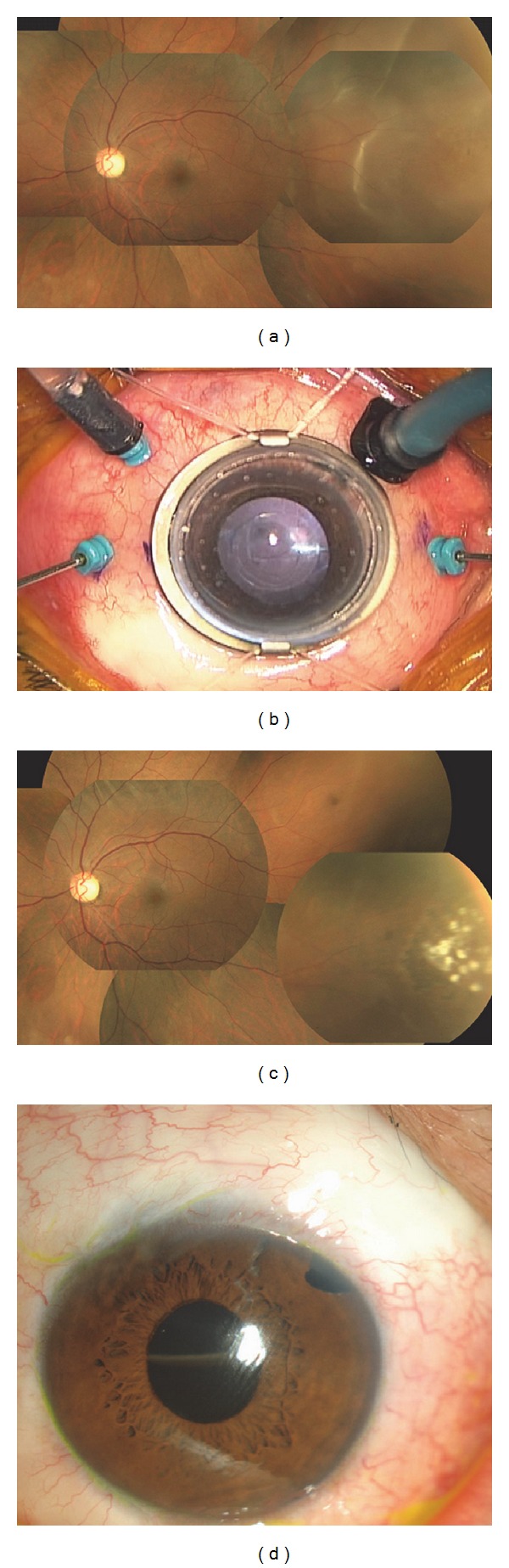 Figure 2