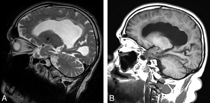 Fig 3.