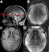 Fig. 2