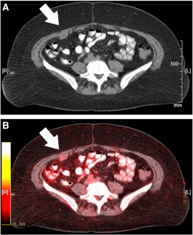 Fig. 1