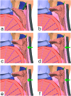 Figure 11.