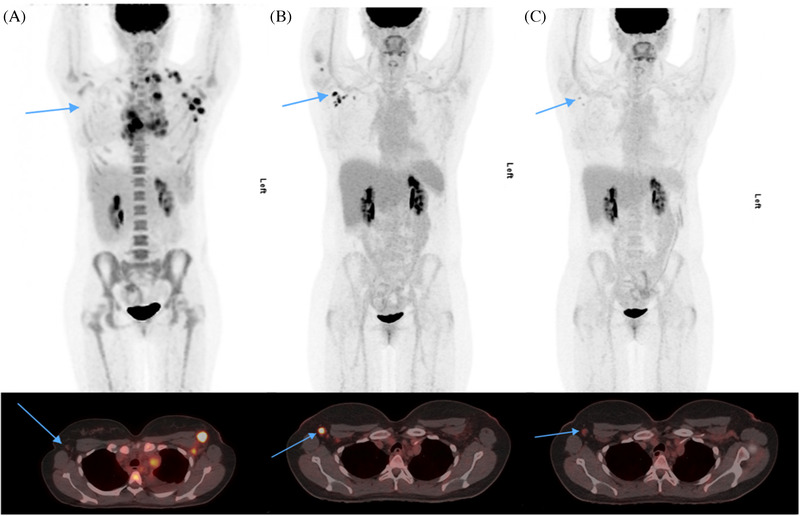 FIGURE 1