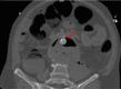 Fig 1