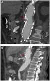 Fig 2