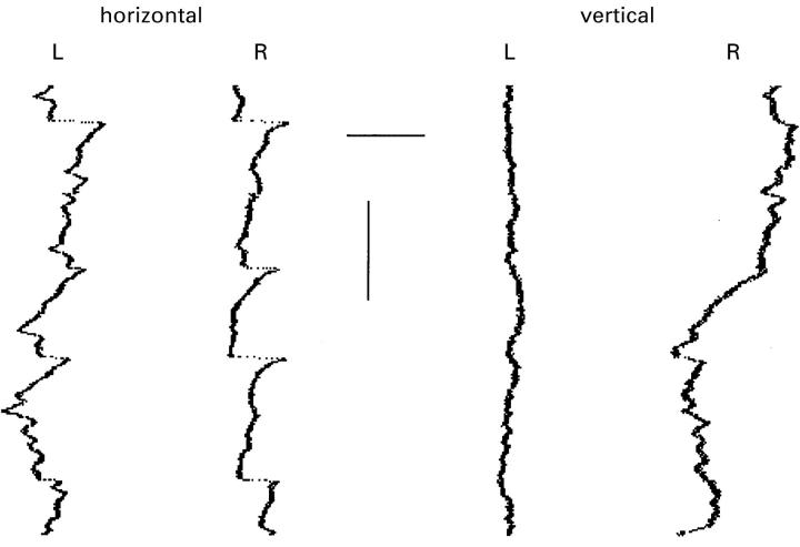 Figure 1  