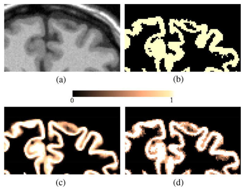 Fig. 11