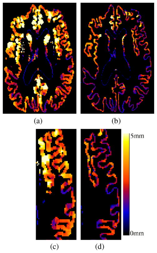 Fig. 15