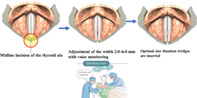 graphic file with name LIO2-7-1481-g003.jpg