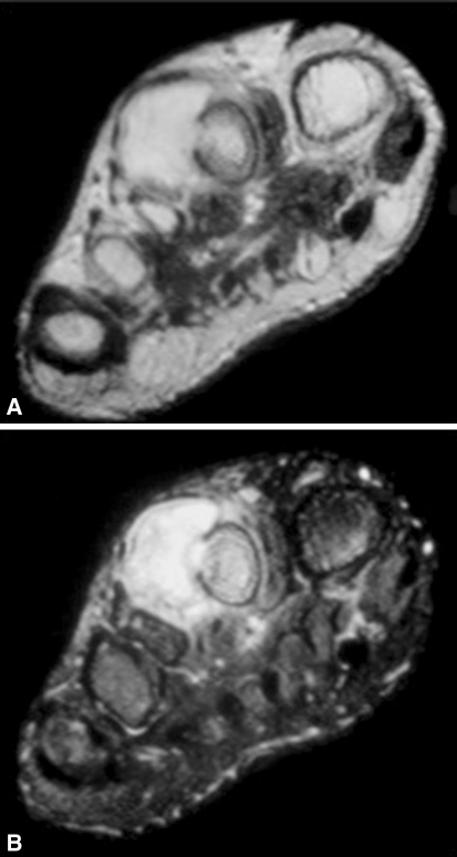 Fig. 5A–B