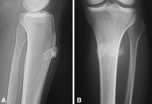 Fig. 3A–B