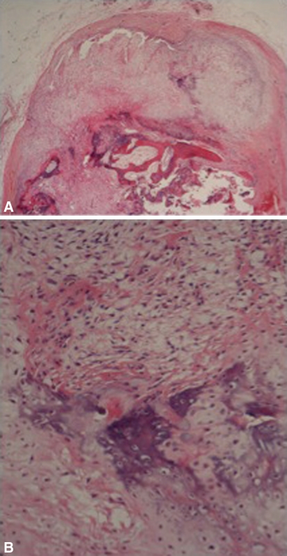 Fig. 1A–B