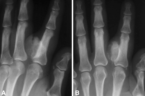 Fig. 4A–B