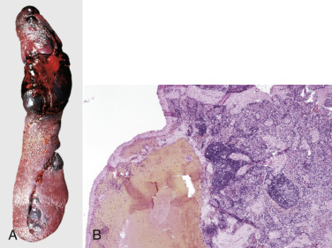 Figure 13-63