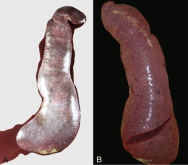 Figure 13-54