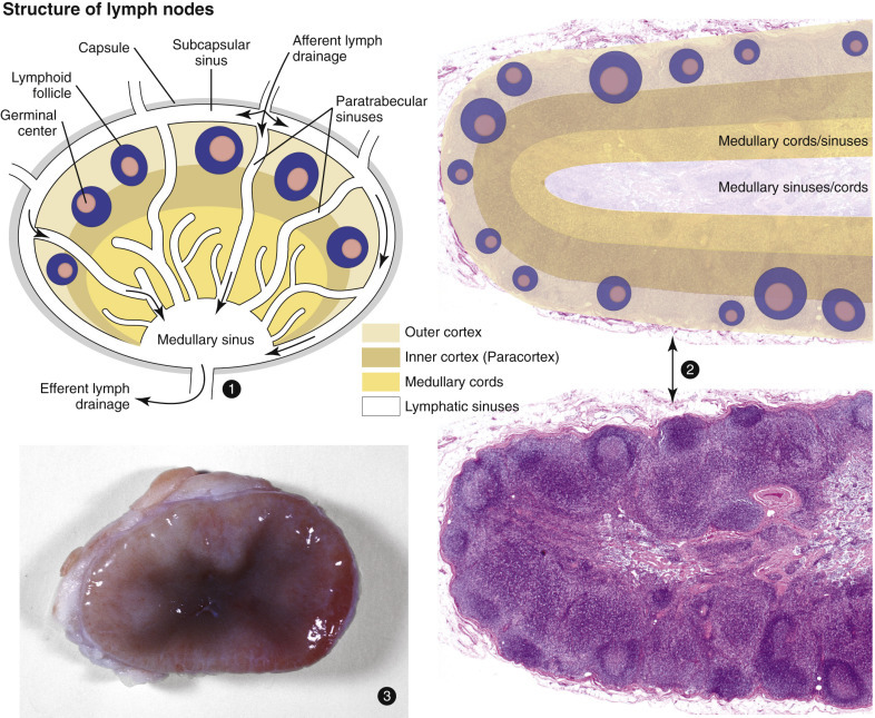 Figure 13-45