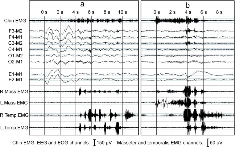 Fig. 4