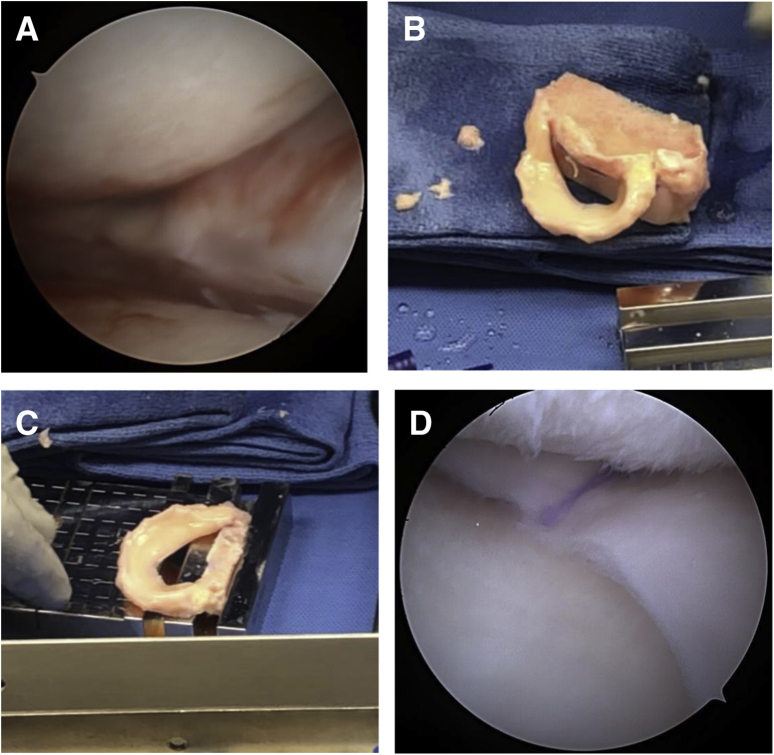 Fig 4