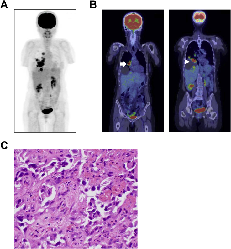 Fig. 1