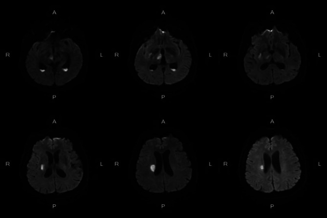 Fig. 2