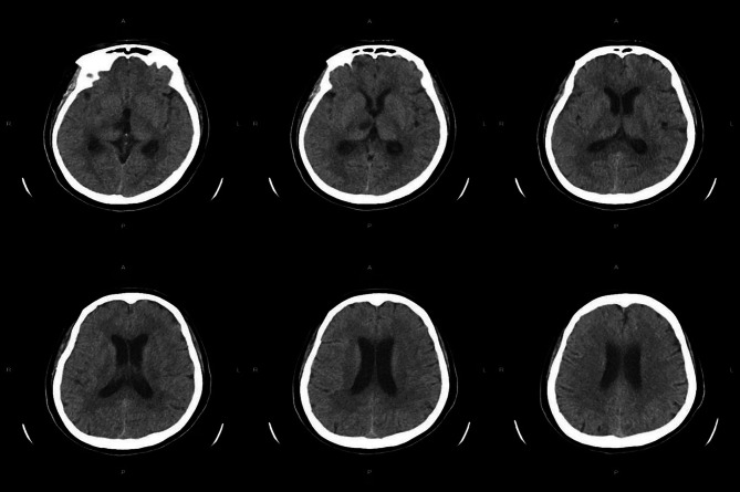 Fig. 1