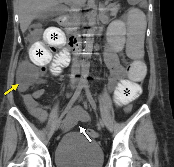 Figure 10b.