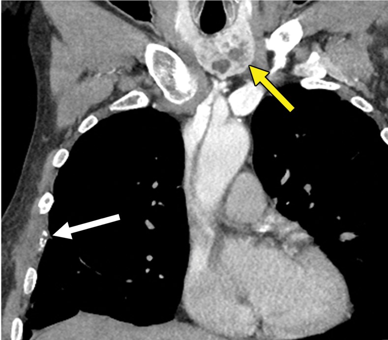 Figure 1b.