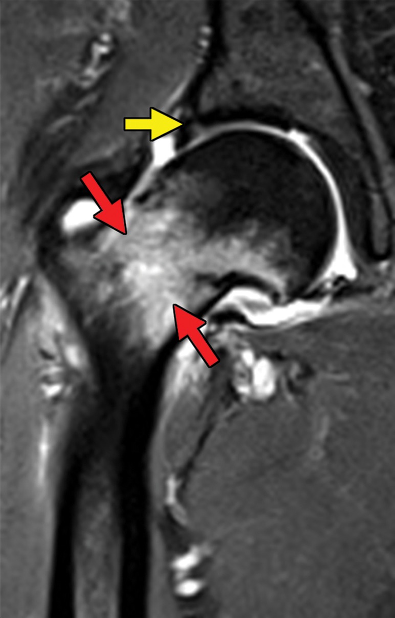 Figure 6d.