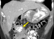Figure 4d.