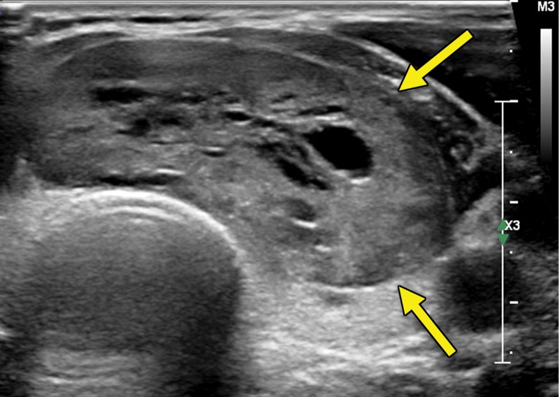 Figure 1c.