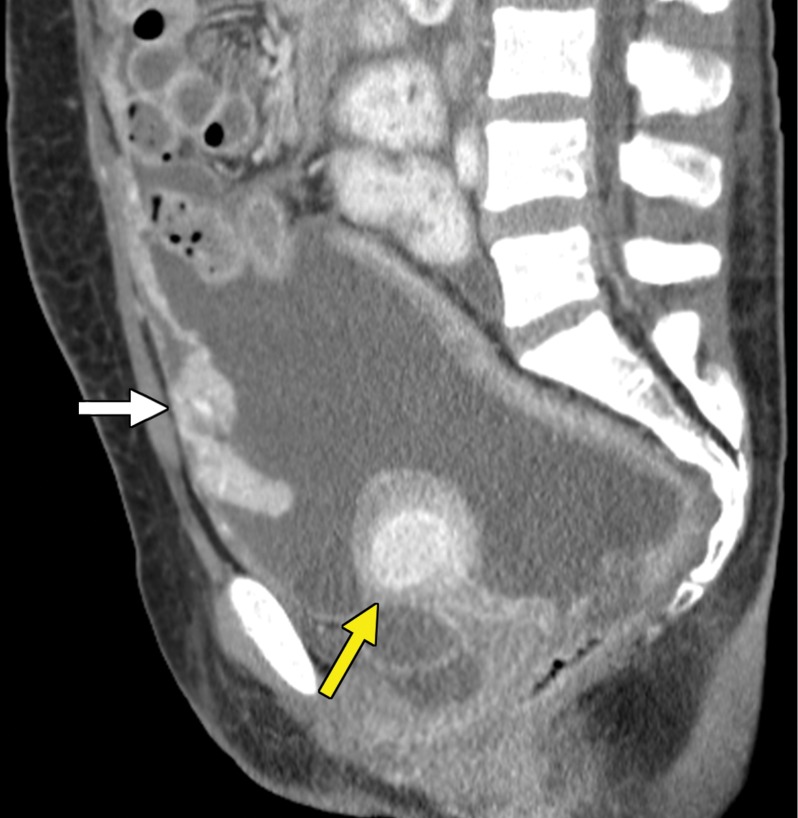 Figure 3c.