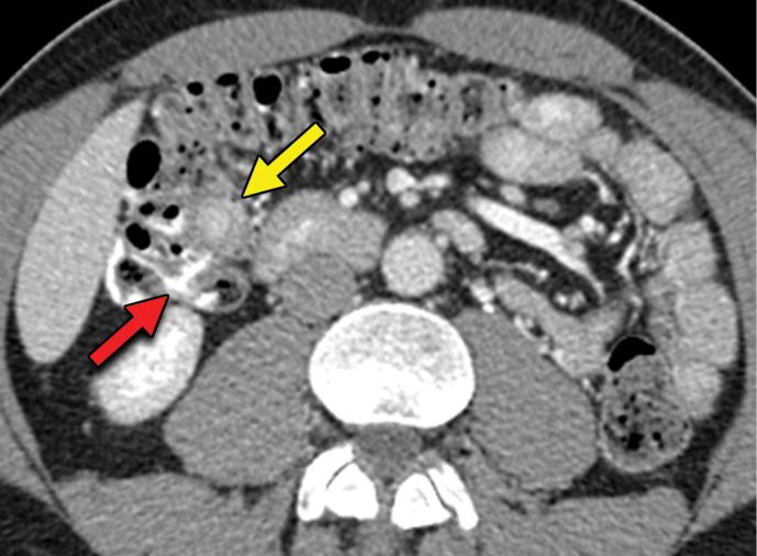 Figure 4b.