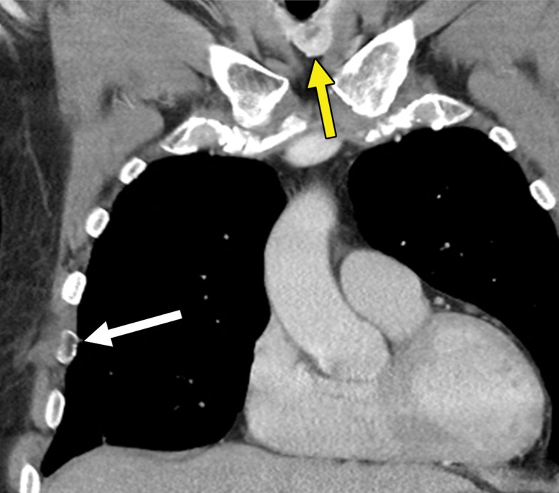 Figure 1a.