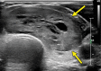 Figure 1c.