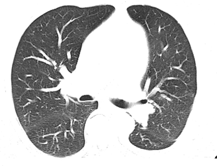 Figure 9c.