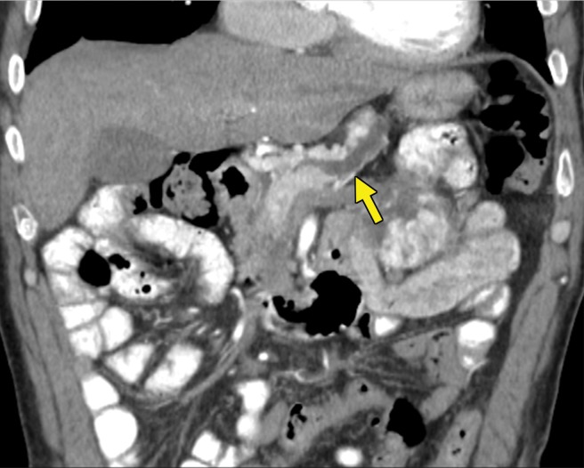 Figure 5b.