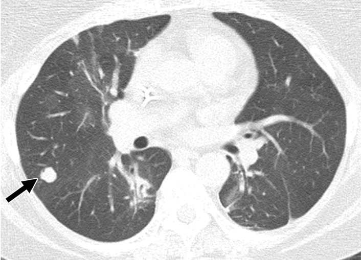 Figure 11b.