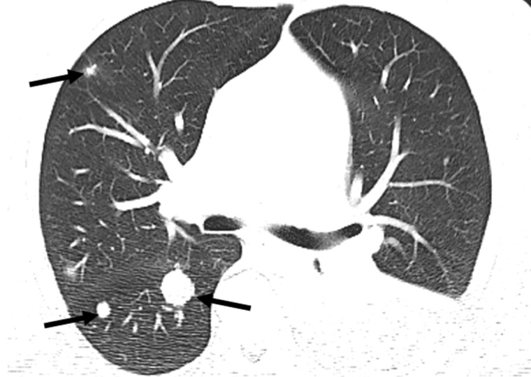 Figure 9b.