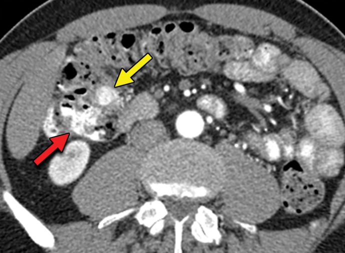 Figure 4a.