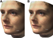 Fig. 10.