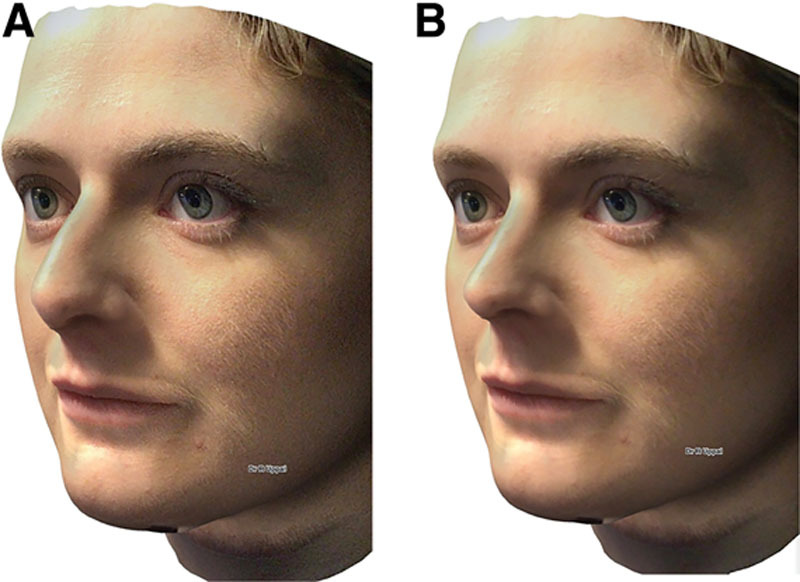 Fig. 10.
