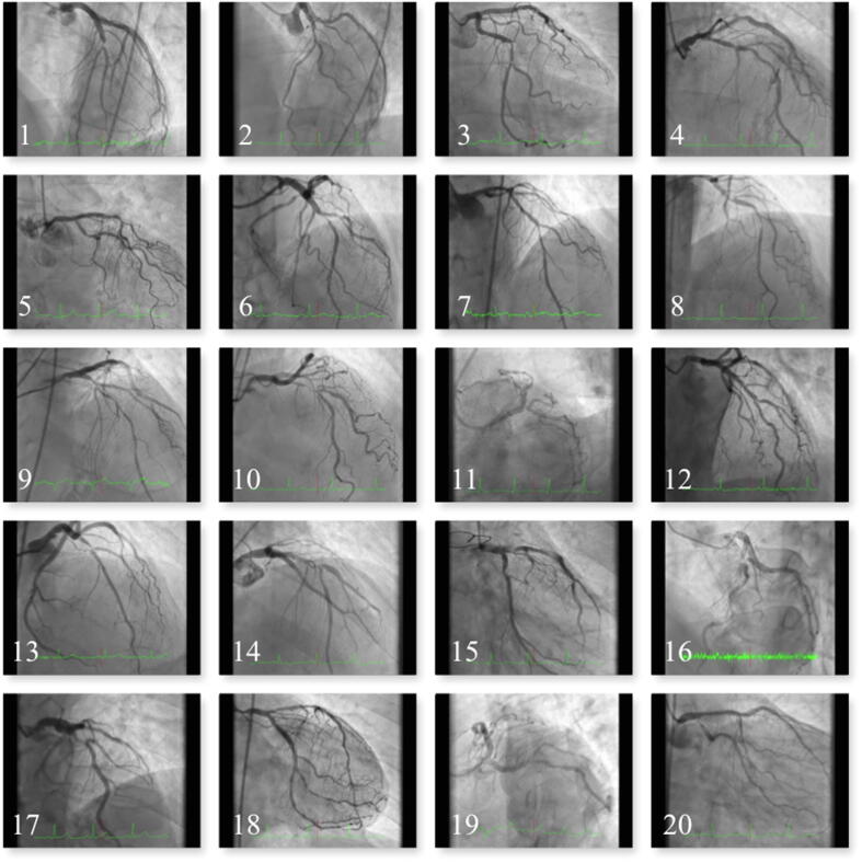 Fig. 3