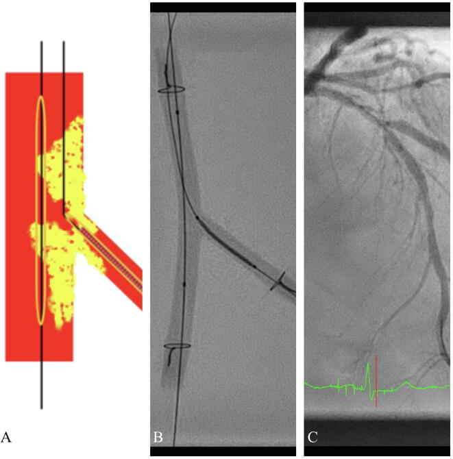 Fig. 2