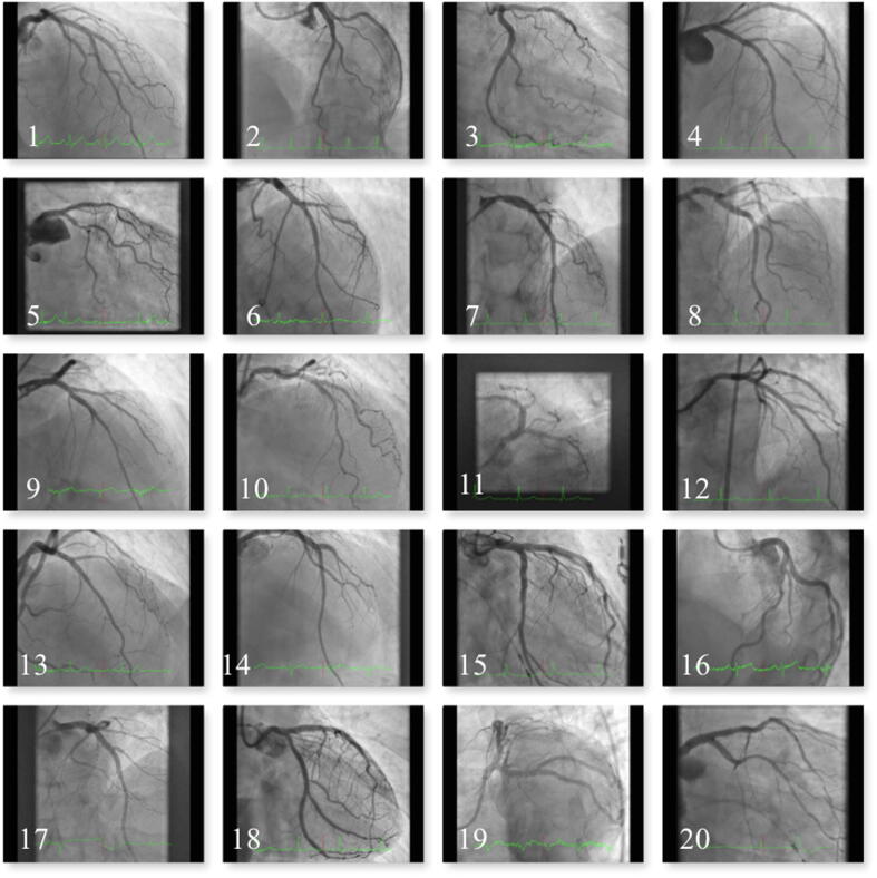 Fig. 4